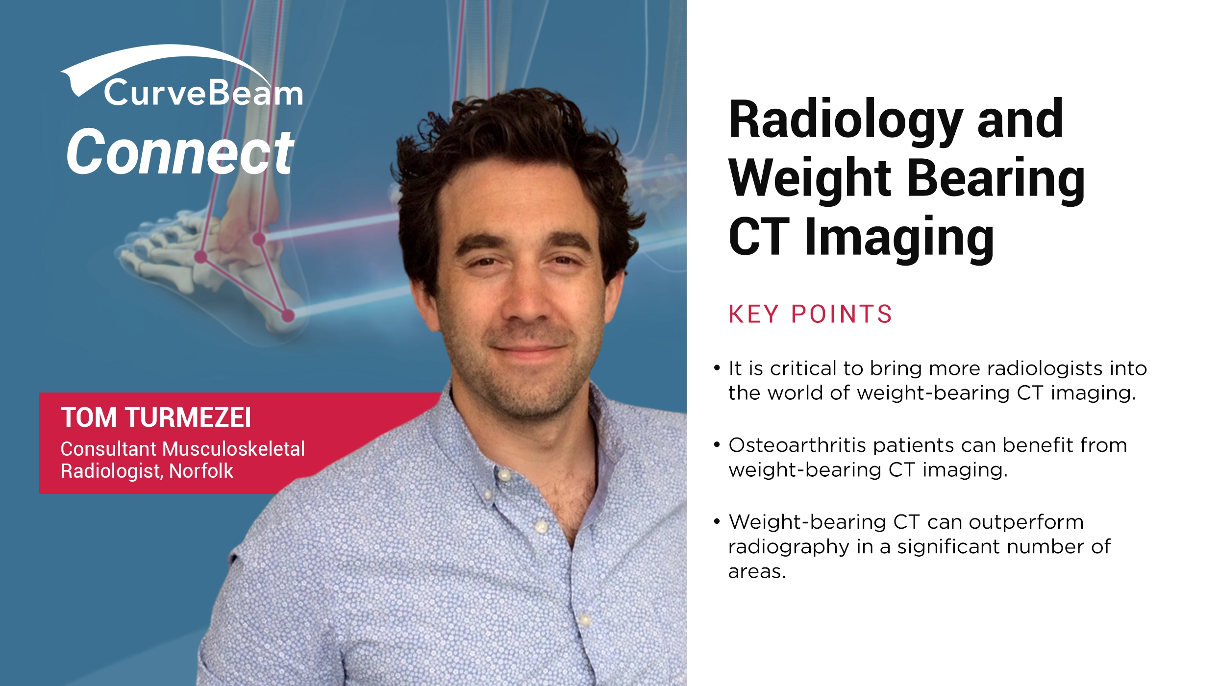 CurveBeam Connect Radiology and Weight Bearing CT Imaging MarketScale