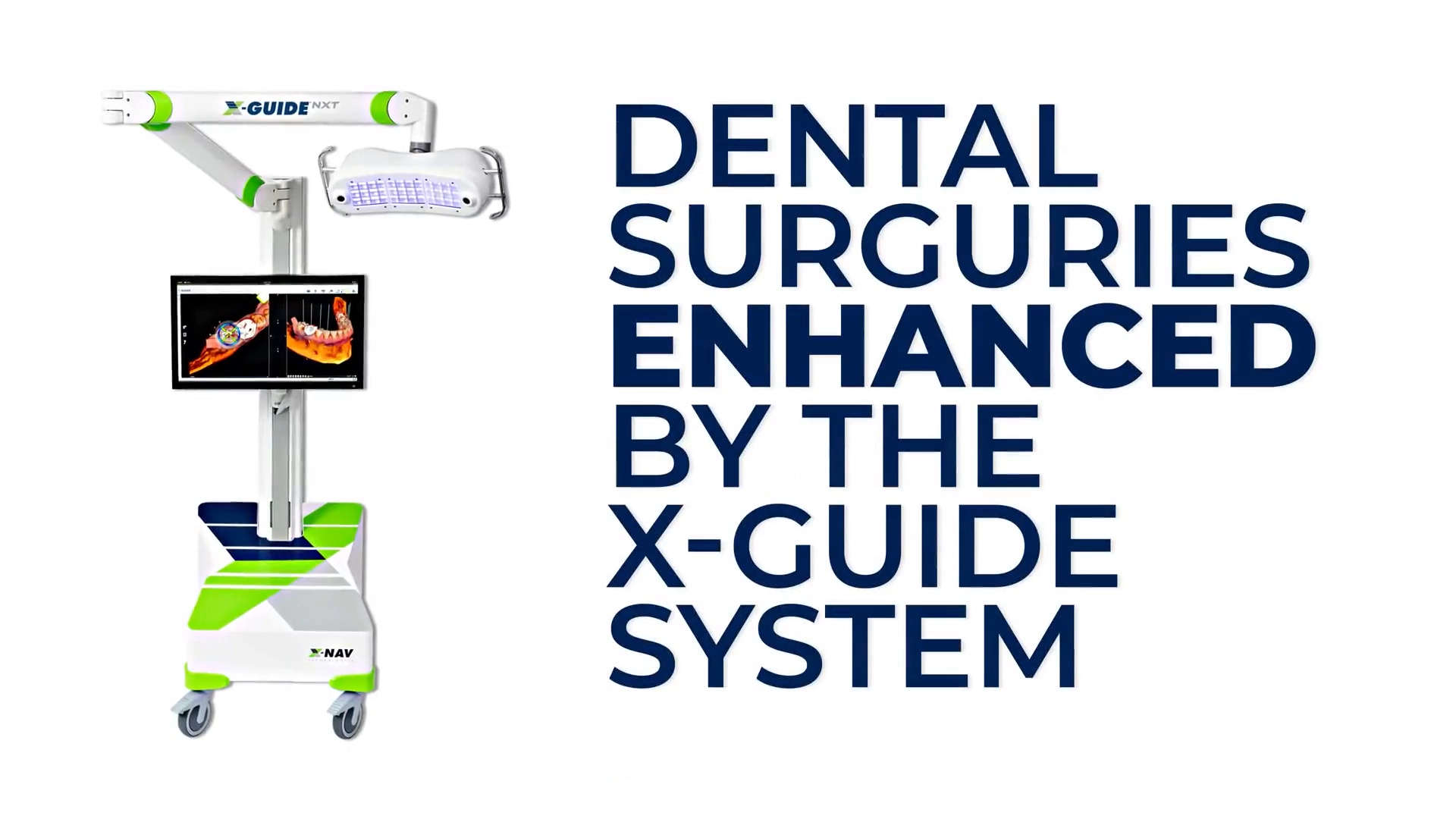 Dental Surgeries Enhanced by The X-Guide System: Elevating Dentist and Patient Experiences